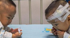 Niečo nepredstaviteľné. Rodičia sa mali rozhodnúť, ktoré z dvojčiat nechajú žiť