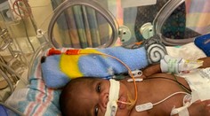 Na svete nie je nikto iný ako on. Chlapec svojím narodením prekonal svetový rekord