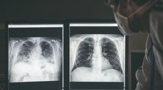 Kľúčové zistenie o dlhom covide: Nová metóda odhalila poškodenie pľúc, ktoré sme si doteraz nevšimli