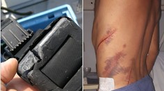 Opitý Čech vrazil člnom do potápača v Chorvátsku. Spôsobil mu hlboké rany až po kosť