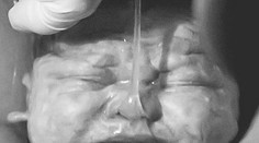 Sociálna sieť zakázala fotku čerstvo narodeného bábätka. Tu je dôvod