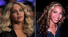 Beyoncé na nových fotkách. Chirurg prezradil, čo všetko si nechala vylepšiť