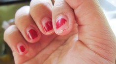 Nielen ohryzené nechty a ruky medzi stehnami o vás prezradia veľa