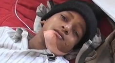 Chudák chlapec. Neuveríte, koľko zubov mu museli lekári odstrániť