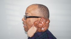 Bola to bežná návšteva u holiča, dve ranky od žiletky mu zničili život