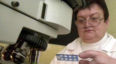 Pohlavné choroby na Slovensku: Nakazené sú aj dievčatá do 15 rokov