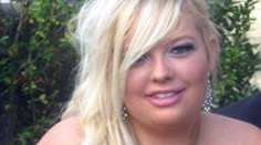 Z bacuľky je dnes poriadna kosť. Lekári jej odstránili tri kilá ovisnutej kože