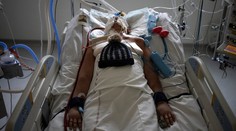 Nové príznaky covidu, ktoré spôsobuje najmä variant omikron. Sledujte si pery, pokožku aj nechty