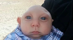 Chlapček bez mozgu prvýkrát prehovoril