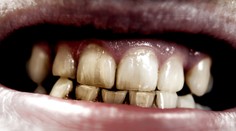 Pozor na týchto deväť mýtov. Môžu vás pripraviť nielen o krásny úsmev