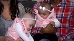 Na tieto dvojčatá sa nebudete vedieť vynadívať. Niečo je na nich zvláštne