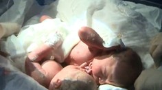 Dawid a Jan sú už rozdelení. Siamské dvojčatá sa narodili zrastené na bruchu