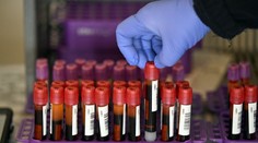 Experiment odhalil, prečo sa niektorí ľudia infikujú koronavírusom a iní nie