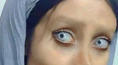 Podstúpila 50 plastík, aby sa podobala na Angelinu Jolie. Vyzerá ako zombie