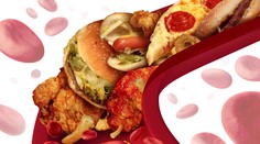 Vysoký cholesterol nie je kamoš. Môže aj za vznik chorôb, na ktoré sa zomiera