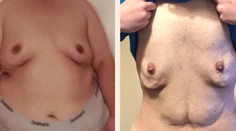 Neuveriteľná premena 200-kilového chlapa. Pozrite, ako vyzerá dnes