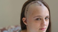 Len 18-ročný chlapec nožom zohavil svoju expriateľku