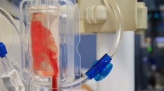 V Martine majú unikátny prístroj, ktorý dokáže bezbolestne určiť druh rakoviny