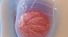 Špeciálny gén zvyšujúci riziko rakoviny je dedičný. Testy vedia odhaliť, či ste jeho nositeľom