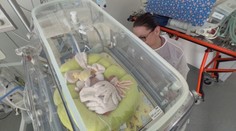 Predčasne narodené deti nevedia samostatne dýchať. V B. Bystrici im k tomu pomáha nová technológia