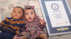 VIDEO: Šanca, že prežijú, sa blížila k nule. Kanadské dvojčatá prekonali svetový rekord