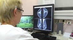 Rezort zdravotníctva odštartoval mamografické skríningy, pacientky budú pozývať na vyšetrenie