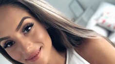 Českej youtuberke popálili na dovolenke tvár. Z komentárov ľudí je na vracanie