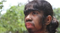 Je v najkrajšom veku, ale musí sa schovávať. Vyzerá ako vlčie dieťa