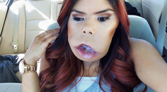 Smejú sa jej, že vyzerá ako opica. V skutočnosti jej ale môžu závidieť