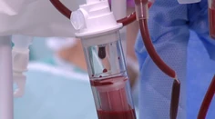 Nakazenému pánovi Vavrovi štátne inštitúcie ublížili dvakrát