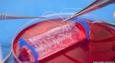 Zázrak modernej medicíny: Tínedžerkám implantovali „umelé" vagíny