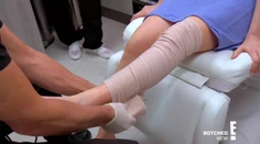 Ako malému dievčatku jej amputovali nohu. Roky neskôr sa ukázalo, že bola obeťou nesprávnej lekárskej starostlivosti