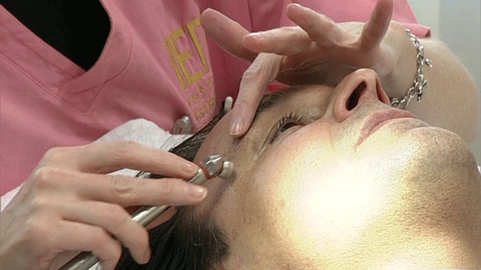 Menej je viac. Extrémne estetické úpravy registrujú lekári už aj na Slovensku