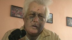 Takto brutálne dobili malí fagani 58-ročného Viliama zo Spiša. Pre pár eur.