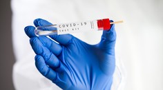 COVID-19: Denne má vo svete pribudnúť len niekoľko desiatok mŕtvych. Ide o hoax