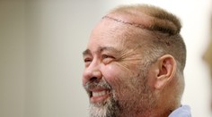 Lekári v Texase ako prví vo svete transplantovali pacientovi časť lebky