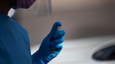 Nový test odhalí rakovinu roky pred jej prejavmi. Má vysokú mieru úspešnosti