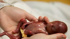 Rodina zverejnila fotografie svojho 19-týždňového chlapčeka. Tu je dôvod