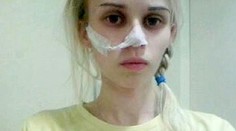 Sophie bojuje s anorexiou. Kalórie vraj aj dýcha