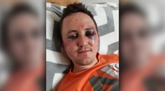 Brata Jána Kuciaka Jozefa napadli neznámi útočníci. So zraneniami leží v nemocnici