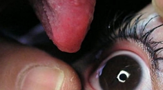 Babička tvrdí, že má zázračné sliny. Neuveríte, čo s nimi lieči