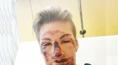 VIDEO: Hrôzostrašný pád počas tréningu. Rakúsky skokan na lyžiach sa druhýkrát narodil