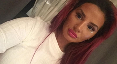 Zuzana Plačková radikálne zmenila imidž. Nový nos aj vlasy