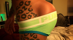 Muž posadnutý plastikami si dal implantáty do zadku. Ako na tomto môže sedieť?