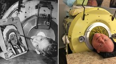 Zomrel muž, ktorý prežil 70 rokov uväznený v železných pľúcach. Napriek ťažkému hendikepu ​vyštudoval právo