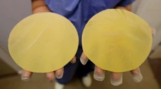 Súd rozhodol v kauze nekvalitných prsných implantátov, desiatky tisíc žien sa dočkajú odškodného