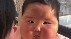 Žena zostala v šoku, keď sa dcére nafúkla tvár a začali jej na nej rásť vlasy. Za všetko môže krém