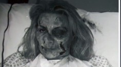Tvár jej znetvoril manžel, dnes je chodiacou reklamou na plastiku