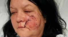 Ženu brutálne zmasakroval pes. Nekonečných 45 minút sa Rachel obávala, že zomrie