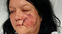 Ženu brutálne zmasakroval pes. Nekonečných 45 minút sa Rachel obávala, že zomrie